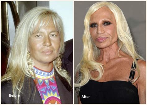 donatella versace ugly